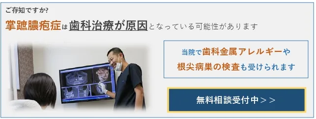 掌蹠膿疱症の無料相談